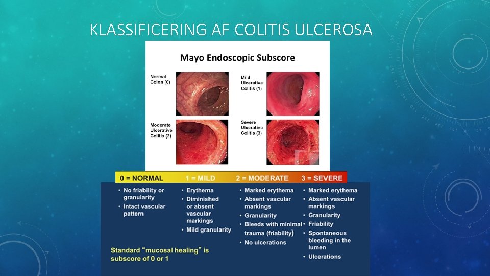 KLASSIFICERING AF COLITIS ULCEROSA 