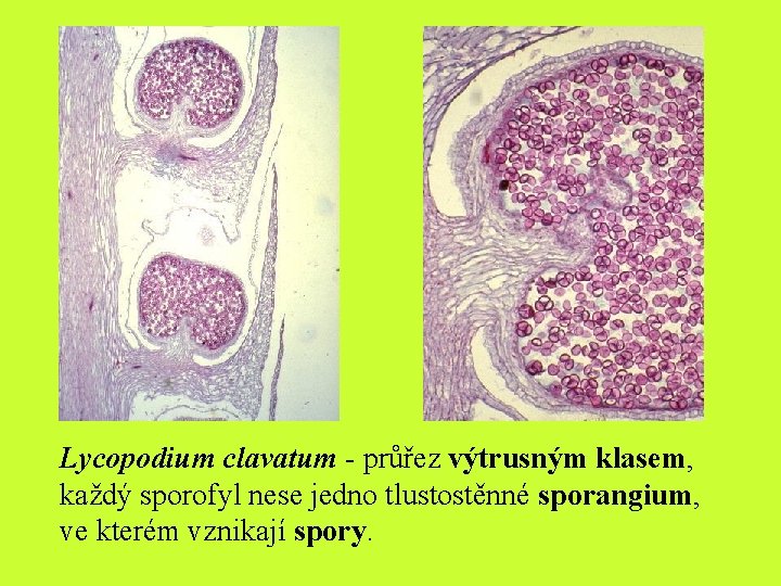 Lycopodium clavatum - průřez výtrusným klasem, každý sporofyl nese jedno tlustostěnné sporangium, ve kterém