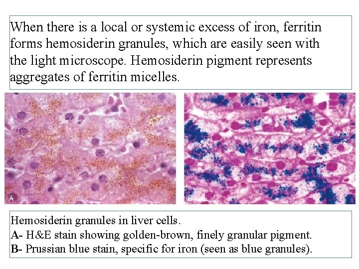 General Pathology Autophagy Intracellular Accumulations Pathologic General Pathology Autophagy Intracellular Accumulations Pathologic