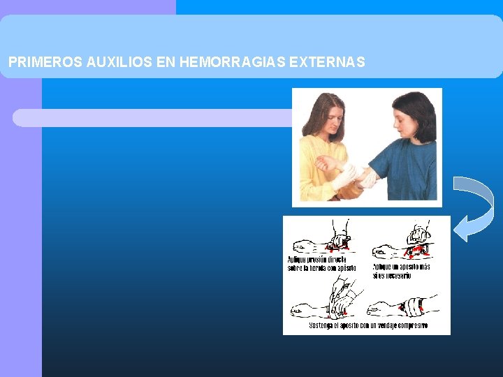 PRIMEROS AUXILIOS EN HEMORRAGIAS EXTERNAS 