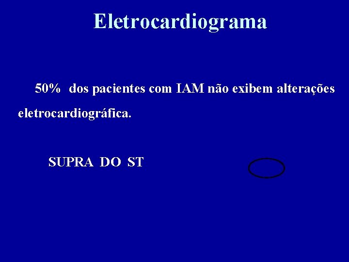 Eletrocardiograma 50% dos pacientes com IAM não exibem alterações eletrocardiográfica. SUPRA DO ST 