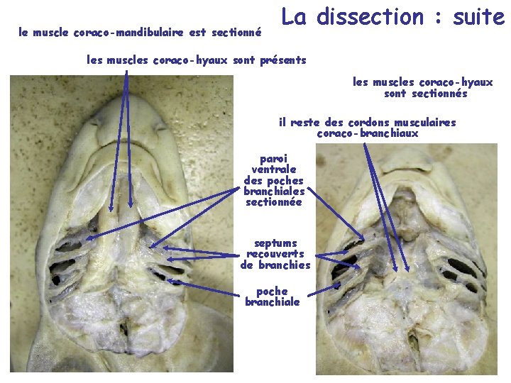 le muscle coraco-mandibulaire est sectionné La dissection : suite les muscles coraco-hyaux sont présents