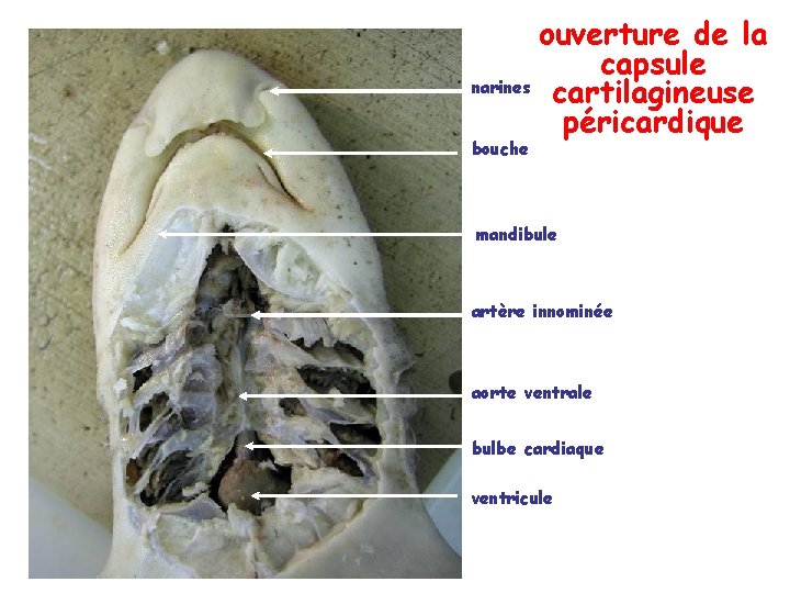 ouverture de la capsule narines cartilagineuse péricardique bouche mandibule artère innominée aorte ventrale bulbe