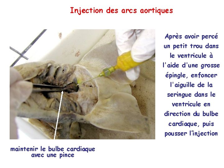 Injection des arcs aortiques Après avoir percé un petit trou dans le ventricule à