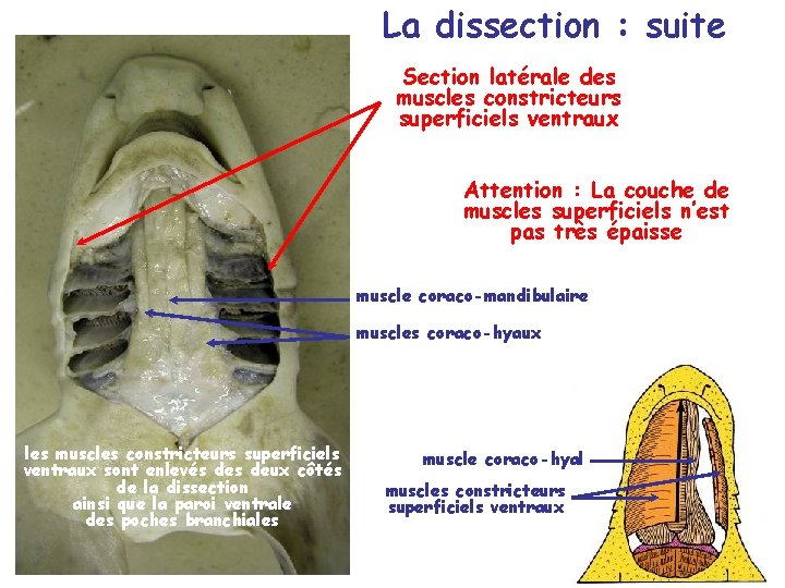 La dissection : suite Section latérale des muscles constricteurs superficiels ventraux Attention : La