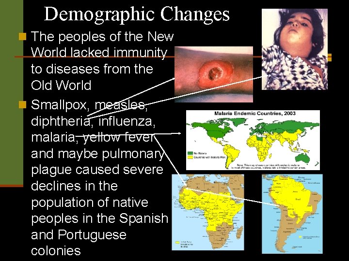 Demographic Changes n The peoples of the New World lacked immunity to diseases from