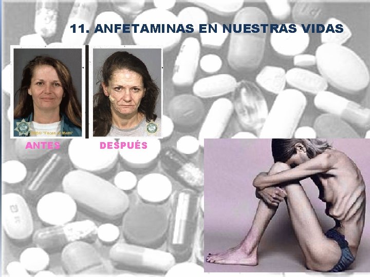 11. ANFETAMINAS EN NUESTRAS VIDAS ANTES DESPUÉS 