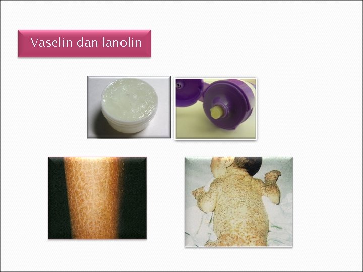 Vaselin dan lanolin 