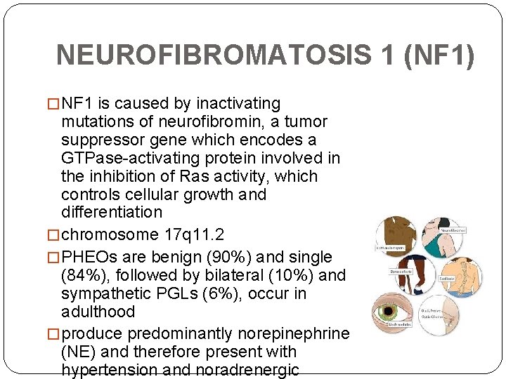 NEUROFIBROMATOSIS 1 (NF 1) � NF 1 is caused by inactivating mutations of neurofibromin, NEUROFIBROMATOSIS 1 (NF 1) � NF 1 is caused by inactivating mutations of neurofibromin,