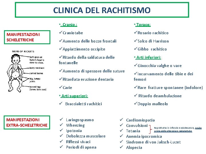 CLINICA DEL RACHITISMO MANIFESTAZIONI SCHELETRICHE • Cranio : • Torace: üCraniotabe üRosario rachitico üAumento