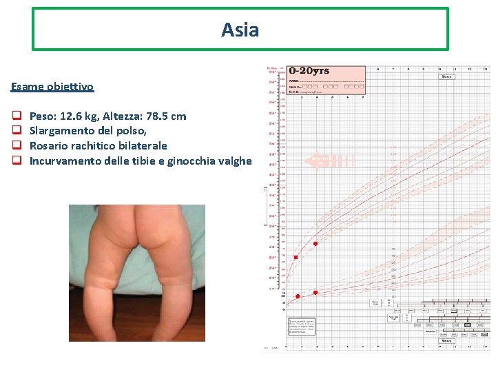 Asia Esame obiettivo q q Peso: 12. 6 kg, Altezza: 78. 5 cm Slargamento