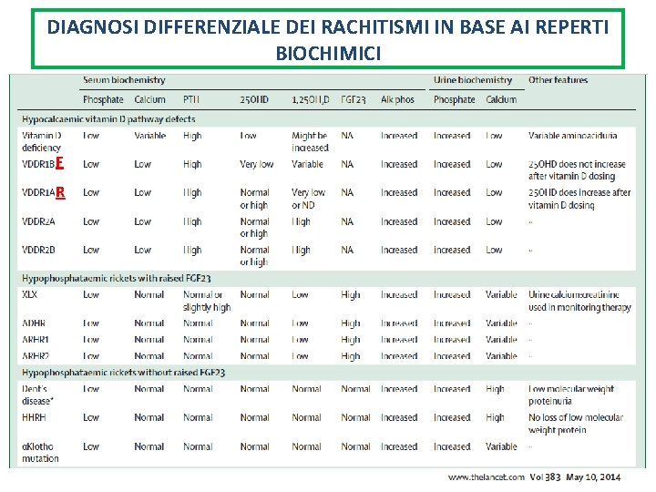 DIAGNOSI DIFFERENZIALE DEI RACHITISMI IN BASE AI REPERTI BIOCHIMICI F R 