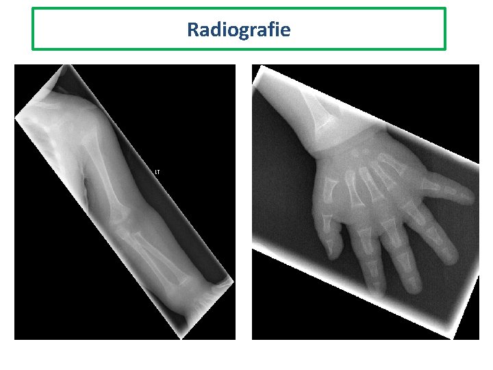 Radiografie 