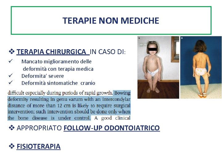 TERAPIE NON MEDICHE v TERAPIA CHIRURGICA IN CASO DI: ü Mancato miglioramento delle deformità