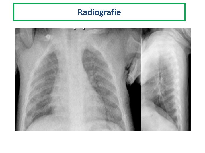 Radiografie 