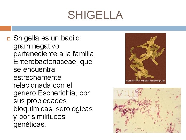 SHIGELLA Shigella es un bacilo gram negativo perteneciente a la familia Enterobacteriaceae, que se