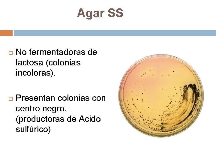 Agar SS No fermentadoras de lactosa (colonias incoloras). Presentan colonias con centro negro. (productoras