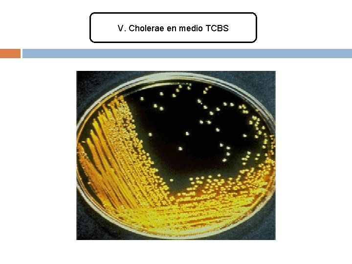 V. Cholerae en medio TCBS 