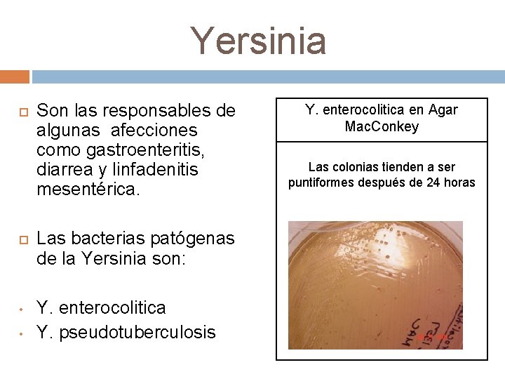 Yersinia • • Son las responsables de algunas afecciones como gastroenteritis, diarrea y linfadenitis