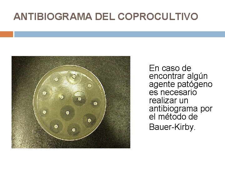 ANTIBIOGRAMA DEL COPROCULTIVO En caso de encontrar algún agente patógeno es necesario realizar un