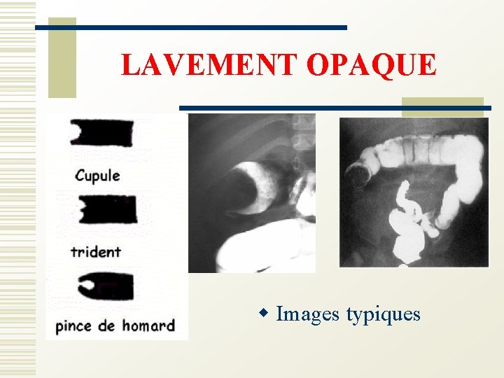 LAVEMENT OPAQUE w Images typiques 