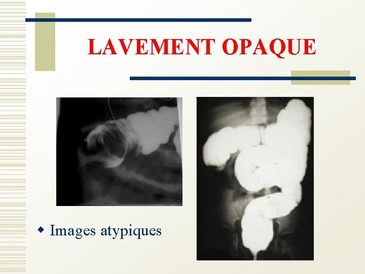 LAVEMENT OPAQUE w Images atypiques 