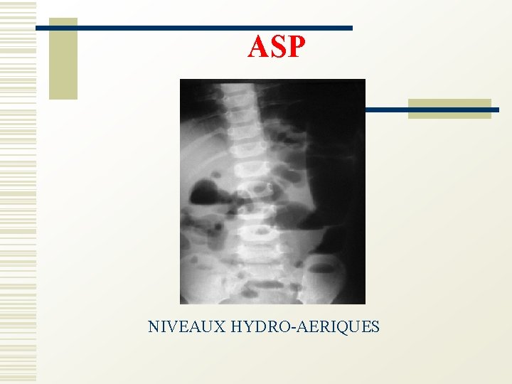 ASP NIVEAUX HYDRO-AERIQUES 