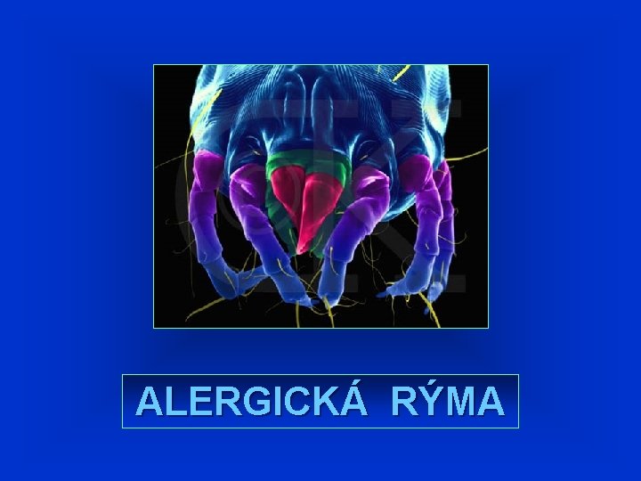 ALERGICKÁ RÝMA ALERGICKÁ RÝMA