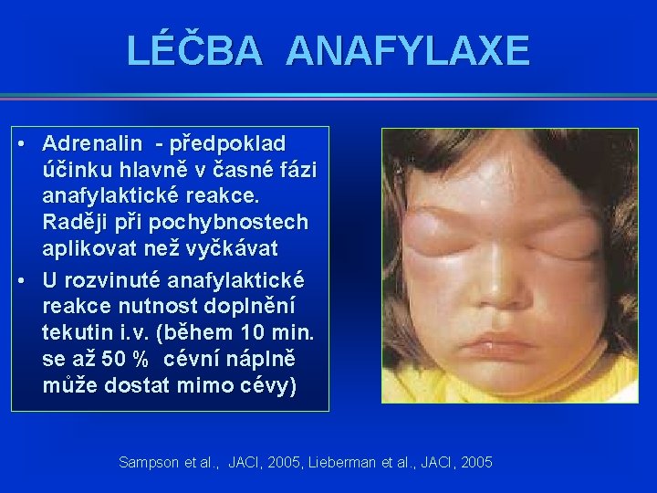 LÉČBA ANAFYLAXE • Adrenalin - předpoklad účinku hlavně v časné fázi anafylaktické reakce. Raději LÉČBA ANAFYLAXE • Adrenalin - předpoklad účinku hlavně v časné fázi anafylaktické reakce. Raději