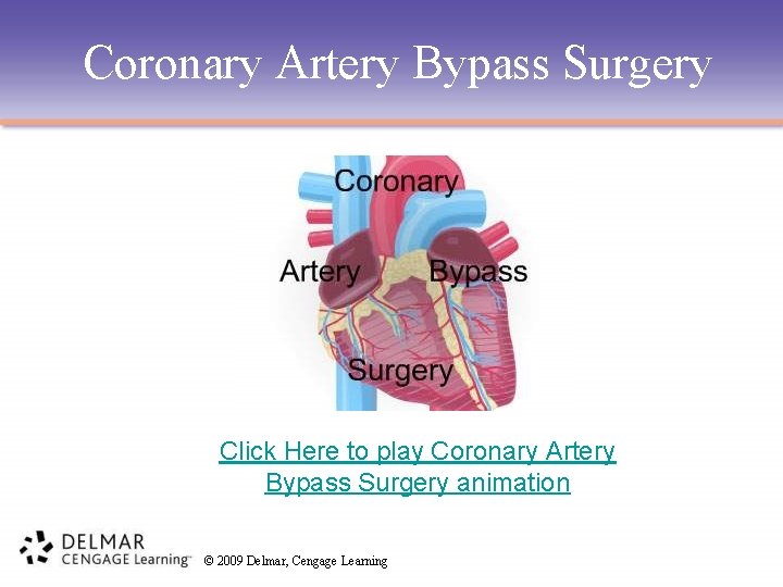 Coronary Artery Bypass Surgery Click Here to play Coronary Artery Bypass Surgery animation ©