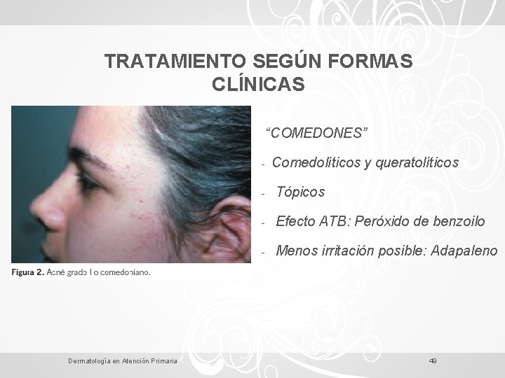 TRATAMIENTO SEGÚN FORMAS CLÍNICAS “COMEDONES” - Dermatología en Atención Primaria Comedolíticos y queratolíticos -