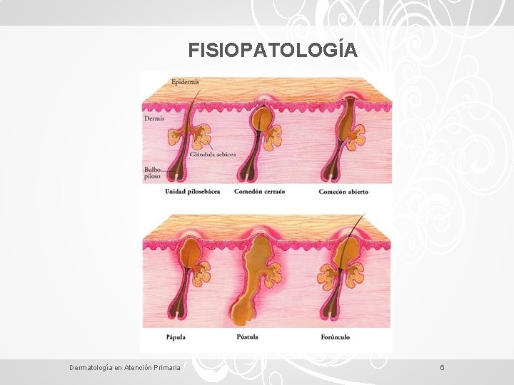 FISIOPATOLOGÍA Dermatología en Atención Primaria 6 