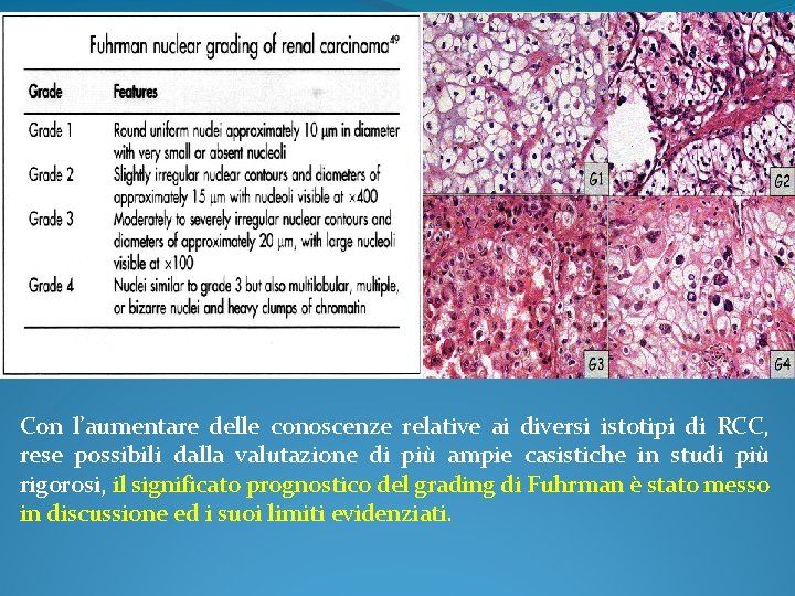 Con l’aumentare delle conoscenze relative ai diversi istotipi di RCC, rese possibili dalla valutazione