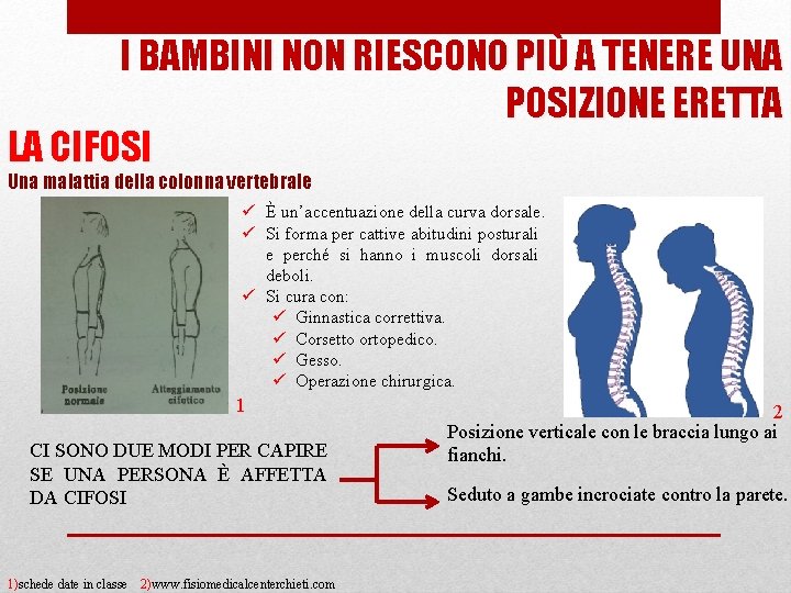 I BAMBINI NON RIESCONO PIÙ A TENERE UNA POSIZIONE ERETTA LA CIFOSI Una malattia