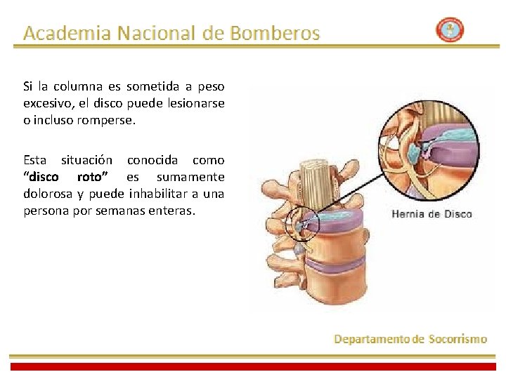 Si la columna es sometida a peso excesivo, el disco puede lesionarse o incluso