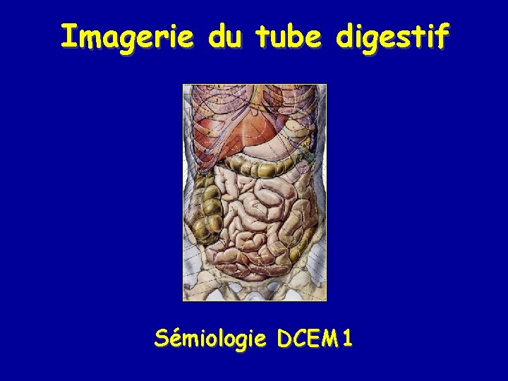 Imagerie du tube digestif Sémiologie DCEM 1 