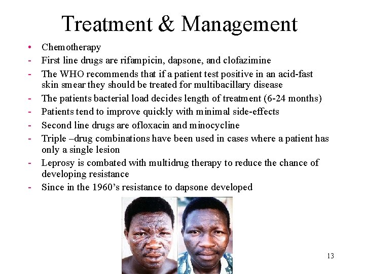 Treatment & Management • Chemotherapy - First line drugs are rifampicin, dapsone, and clofazimine