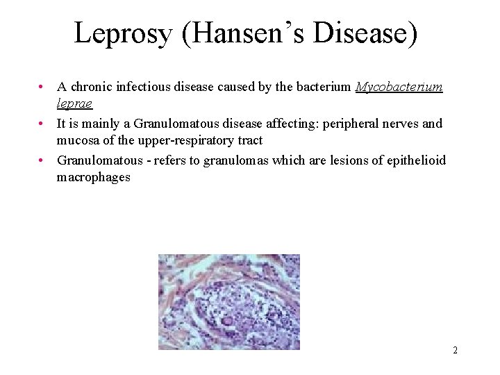 Leprosy (Hansen’s Disease) • A chronic infectious disease caused by the bacterium Mycobacterium leprae