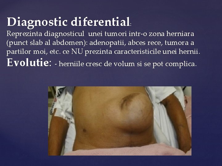 Diagnostic diferential: Reprezinta diagnosticul unei tumori intr-o zona herniara (punct slab al abdomen): adenopatii,