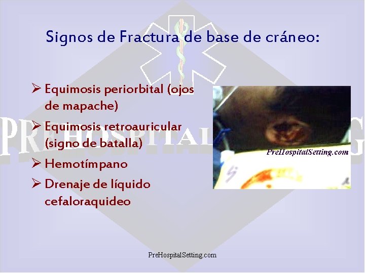 Signos de Fractura de base de cráneo: Ø Equimosis periorbital (ojos de mapache) Ø