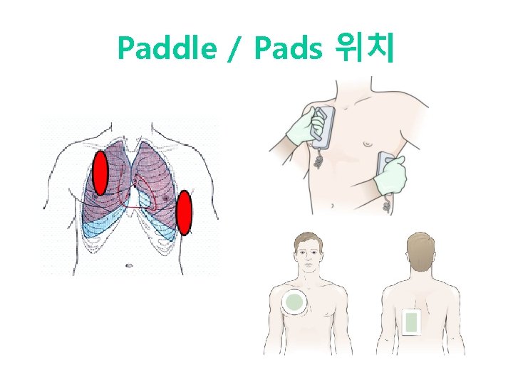 Paddle / Pads 위치 