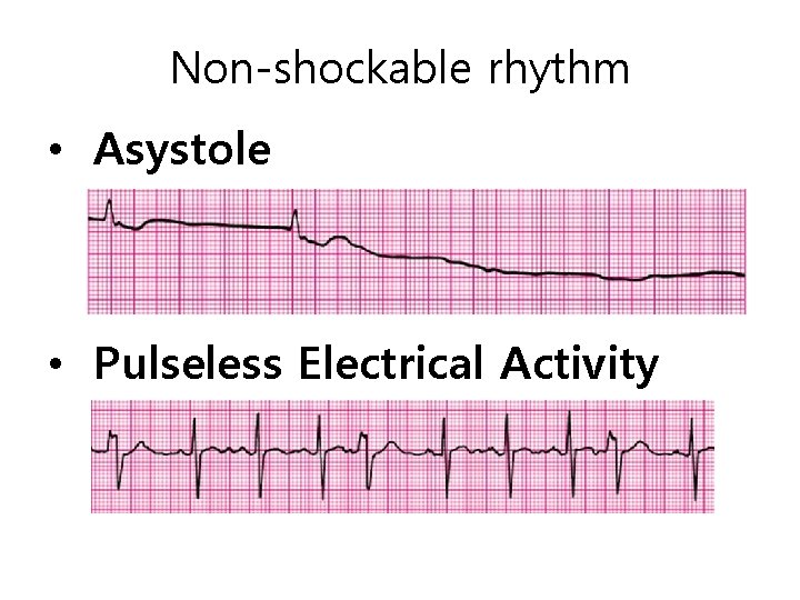 Non-shockable rhythm • Asystole • Pulseless Electrical Activity 