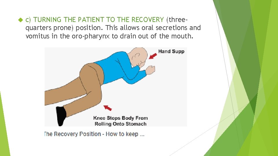  c) TURNING THE PATIENT TO THE RECOVERY (threequarters prone) position. This allows oral