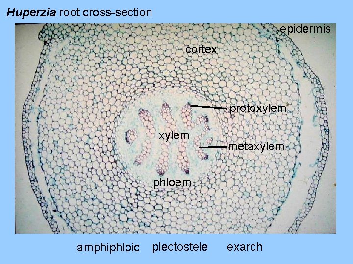 Huperzia root cross-section epidermis cortex protoxylem metaxylem phloem amphiphloic plectostele exarch 