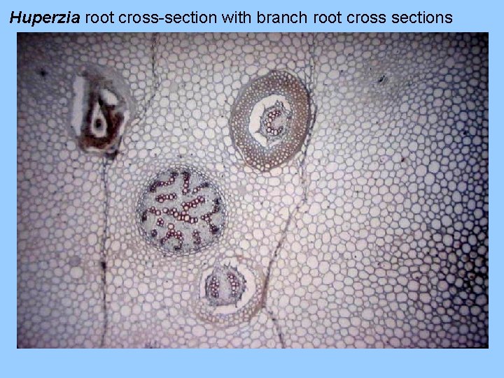 Huperzia root cross-section with branch root cross sections 