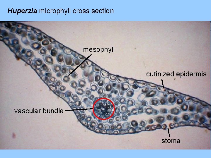 Huperzia microphyll cross section mesophyll cutinized epidermis vascular bundle stoma 