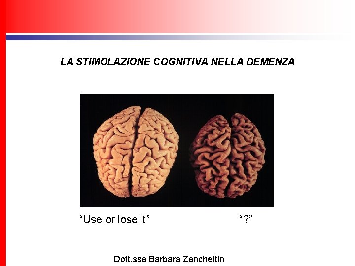 LA STIMOLAZIONE COGNITIVA NELLA DEMENZA “Use or lose it” Dott. ssa Barbara Zanchettin “?