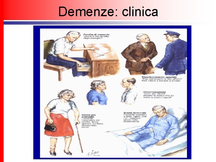 Demenze: clinica 