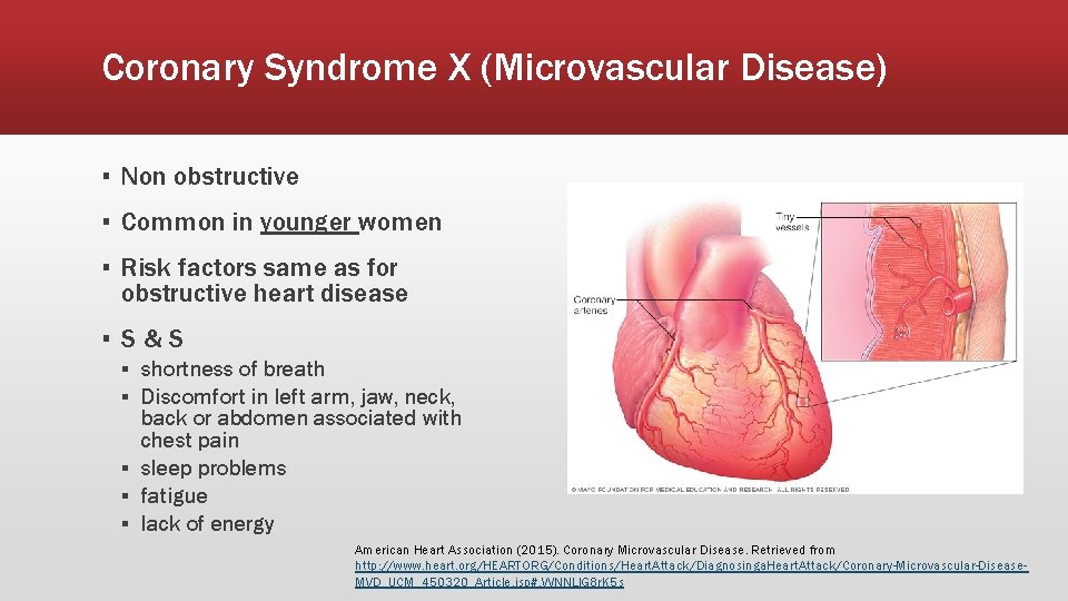 Coronary Syndrome X (Microvascular Disease) ▪ Non obstructive ▪ Common in younger women ▪