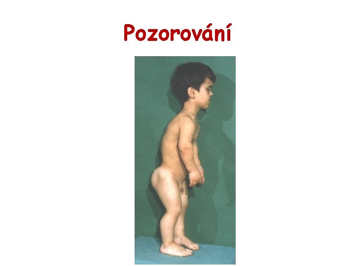 Pozorování 